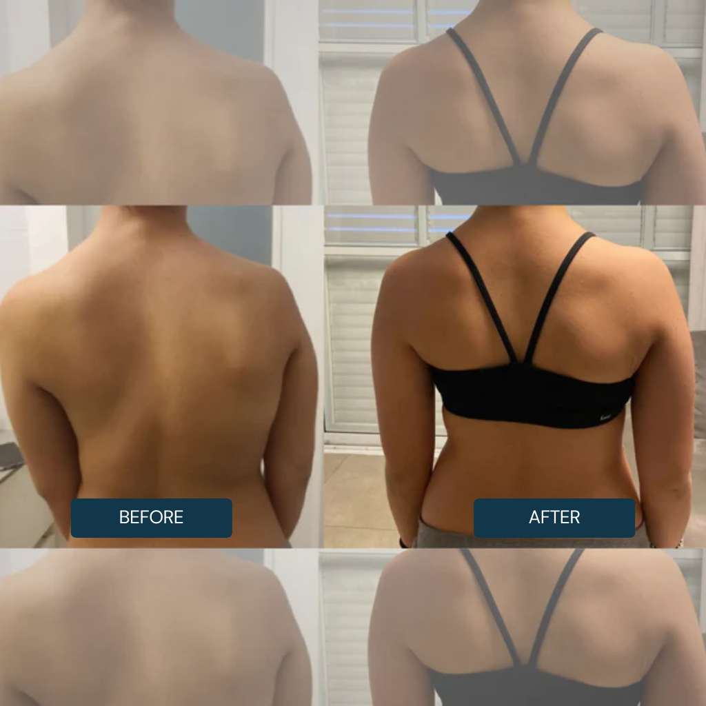 FLEXRELIEF™ Posture Corrector – Relieve Back Pain & Improve Posture