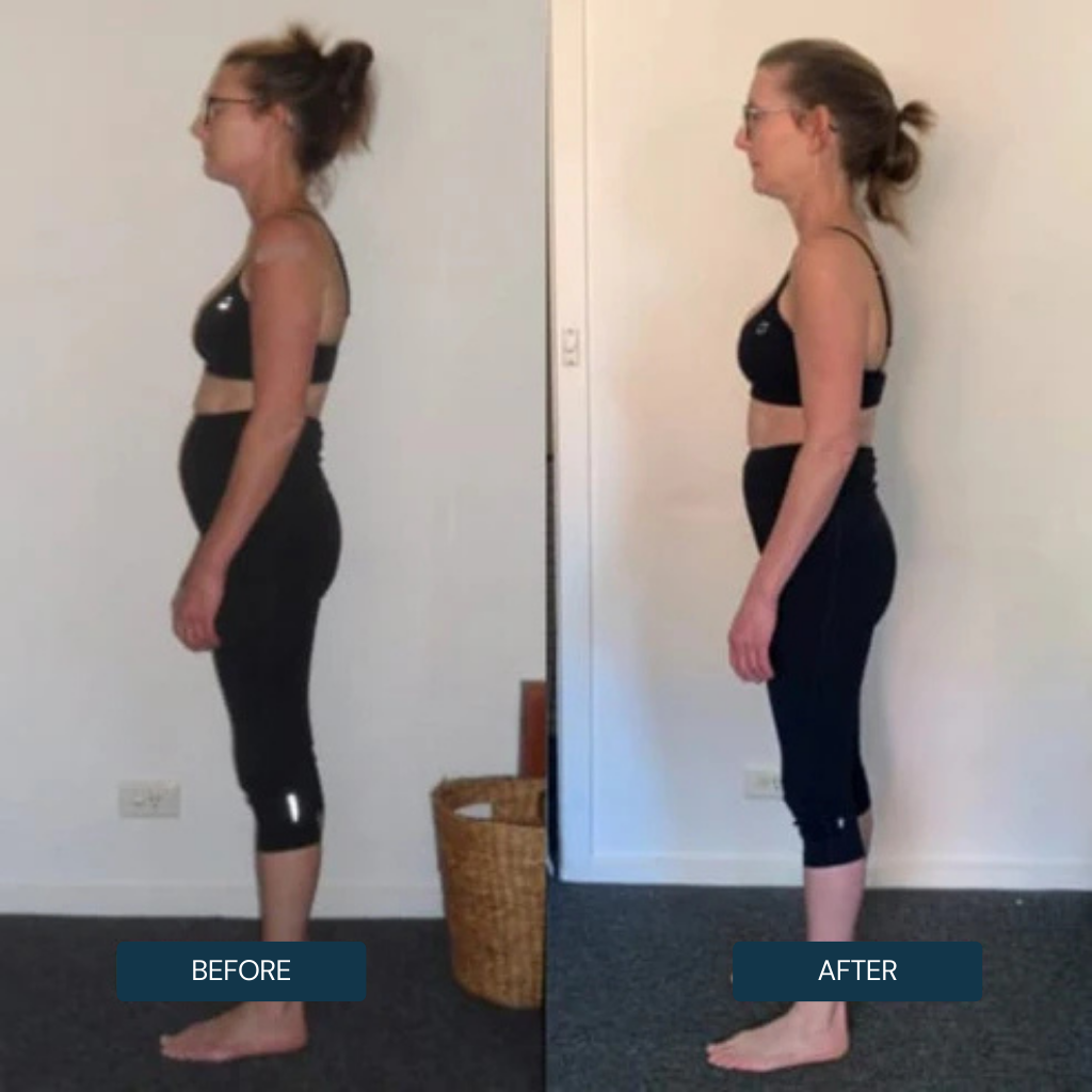 FLEXRELIEF™ Posture Corrector – Relieve Back Pain & Improve Posture